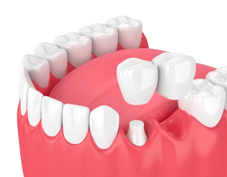 Конструкция консоль