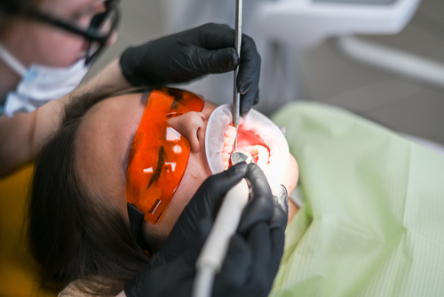 Чистка зубов ультразвуком